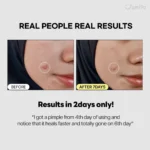 اسنس آبرسان حلزون و پپتید جومیسو 140 میل | Jumiso - Image 4