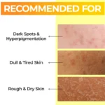 تونر روشن‌ کننده و ضدلک شماره ۵ نامبوزین