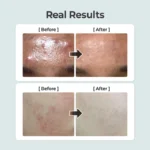 تونر گیاهی تسکین‌ دهنده نامبوزین شماره ۱