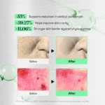 ریدل شات ۱۰۰ وی ‌تی