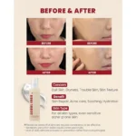 سرم ترمیم کننده سئول 1988