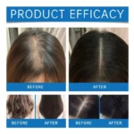 سرم تقویت کننده و ضد ریزش مو سی پوری