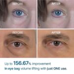 کرم دور چشم ضد چروک درمان پف و تیرگی دکتر ملاکسین | Dr.melaxin eyephalt eyebag cream - Image 6